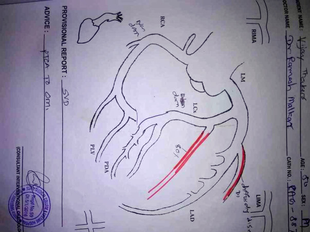 Help Me to Undergo Angioplasty Surgery