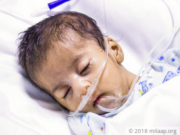 Mother Cannot Afford To Save 2-month-old Whose Own Saliva Chokes Lungs