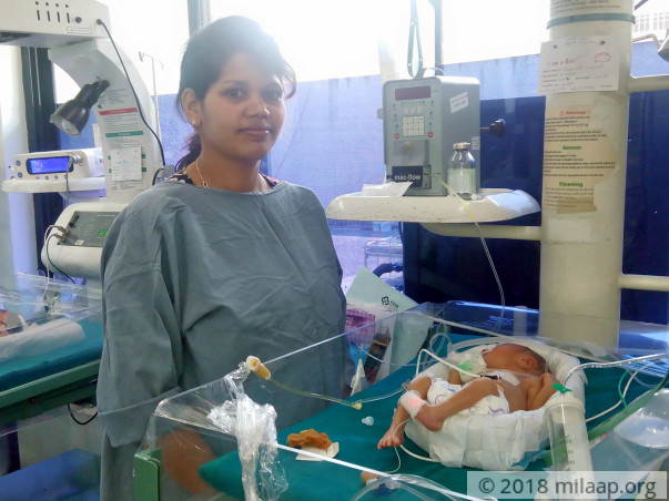 12 Days Old, These Twins Are Fighting Hard To Make It In This World