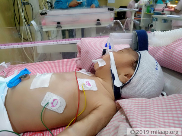 With A Mentally Ill Husband This Mother Is Struggling To Save Her Baby
