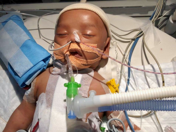 1.5 Month old Mohammed Ahil has to urgently undergo a cardiac surgery