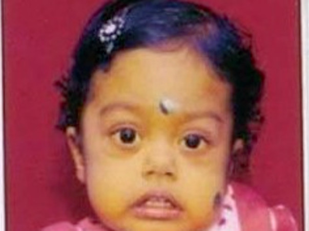Help Baby Aaradhya to undergo Liver transplant surgery