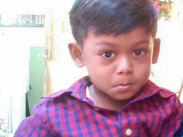 Help JERRY MANOAH fight Lipomeningo myelocoele