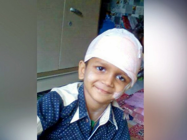 Help Durva Undergo A Crucial Brain Surgery