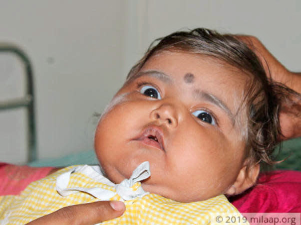 Help My Baby Fight Griscelli Syndrome