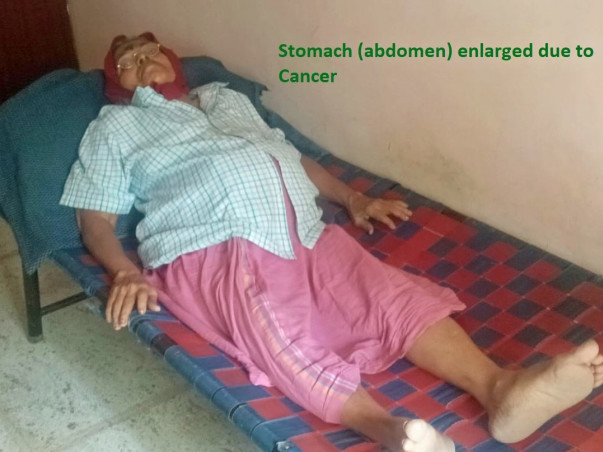 Urgent: Immediate help for taking my Mother to Hospital (treat Cancer)