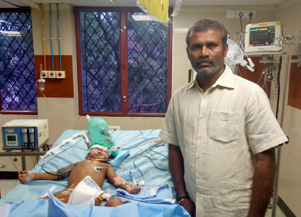 3-year-old Who Drank Paint Thinner Is Suffering From Organ Failure