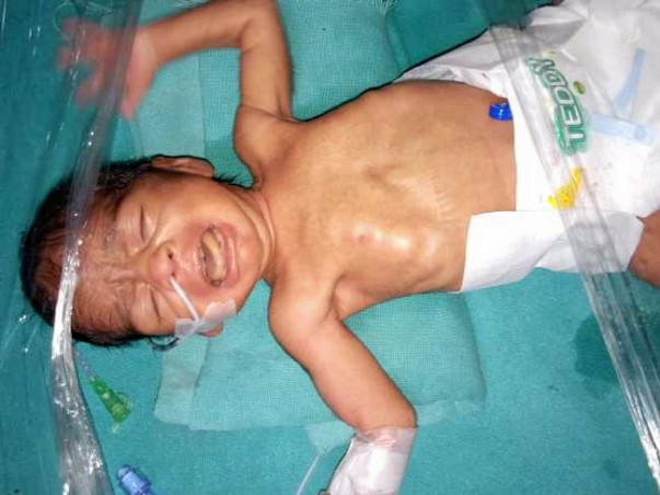 Help premature baby of Kaushal survive NICU journey