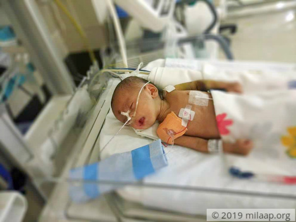 Help 3-month-old Manak fight heart disease