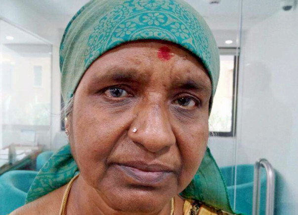 Saraswathi Is A Real Fighter: Help Her Beat Breast Cancer.