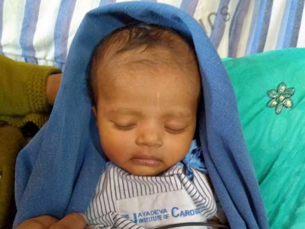 Help 4 Month Old Shravya Get Treated for 3 Holes in her Heart
