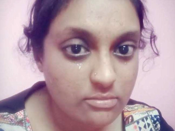 Help For My Eye Surgery