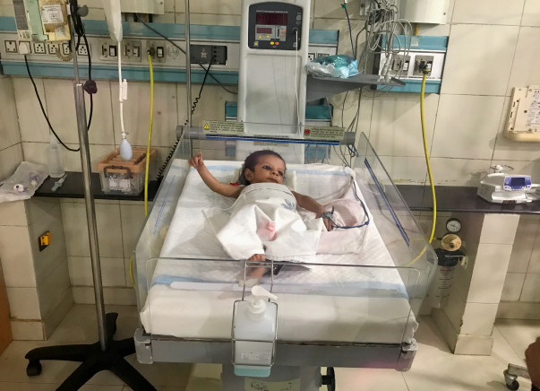 3-month-old Virat Is Battling Death In Need Of A Heart Surgery
