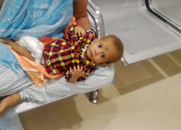 Help 8 month old baby Sahinur undergo an Open Heart surgery