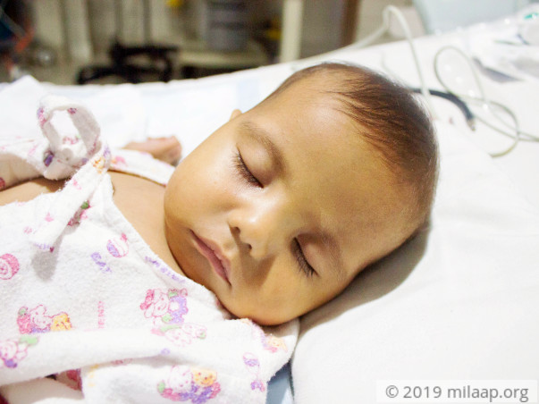With Few Hours Left For Surgery, This Baby's Parents Are Losing Hope