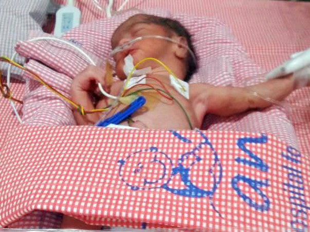 Help to Save the life of 3 weeks old premature born twins