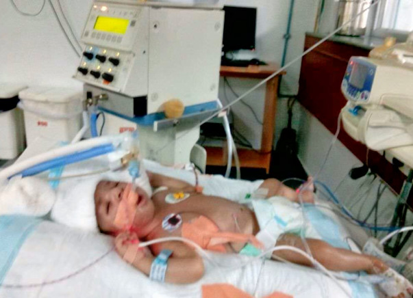 Help Baby of Chaya Fight a Lung Defect