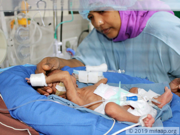 Sabir unnisa needs your support to save her baby