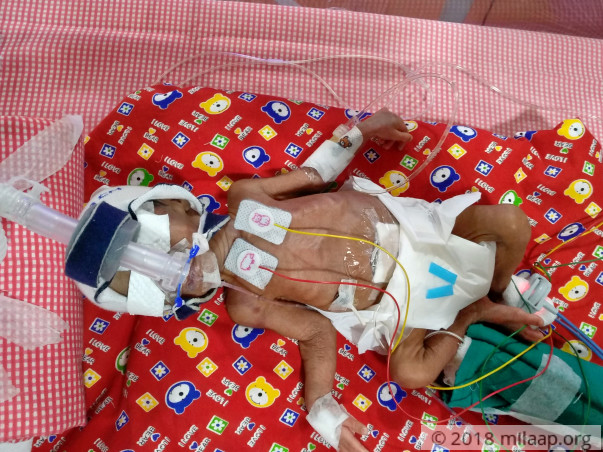 They Begged To Save Their Baby, But It Isn’t Enough To Save Her