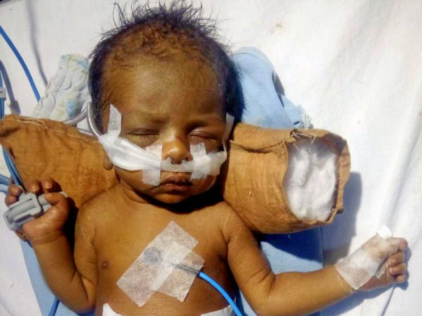 Help Baby Of Rekha Fight Battles In The Hospital.