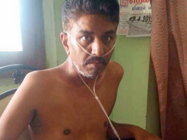 Help Me Undergo A Lung Transplant