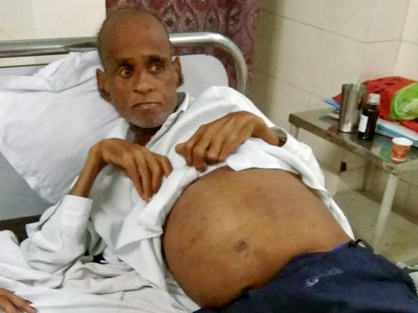 Need Financial Help For My Father's Treatment Of Kidney Failure