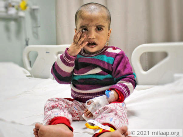 2-Year-Old Who Itches Till He Bleeds Needs A Transplant Urgently