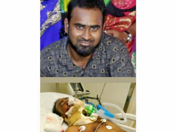 Help My Cousin Get Treated For Multiple Fractures On His Face