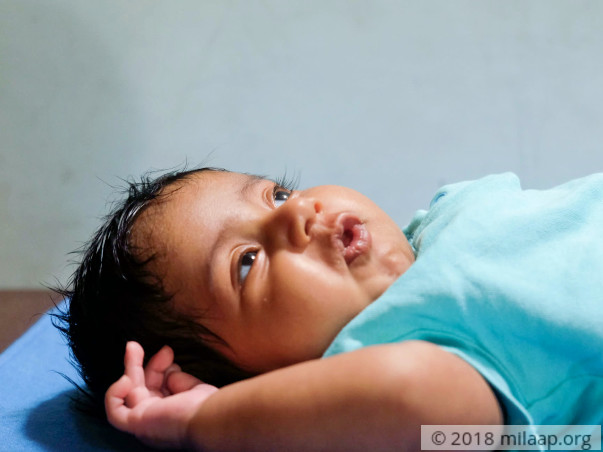2-Month-Old Struggles To Live Due To A Failing Heart