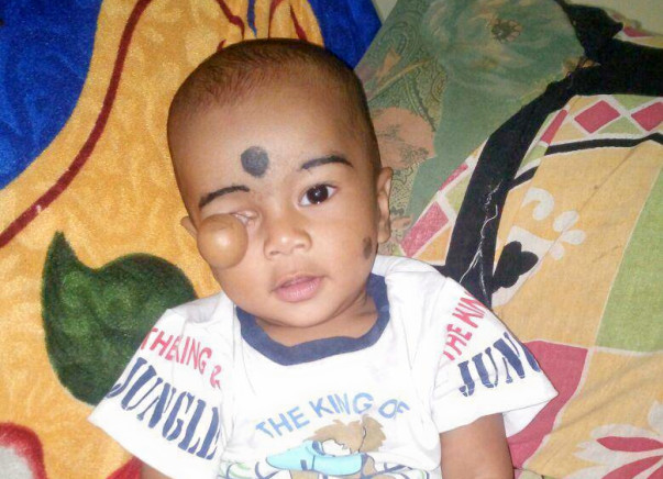 This 10-month-old's Survival Depends On An Open Heart Surgery