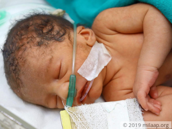 Help Arti's Preterm Baby Survive