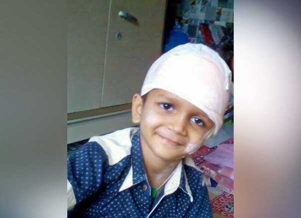 Help Durva Undergo A Crucial Brain Surgery