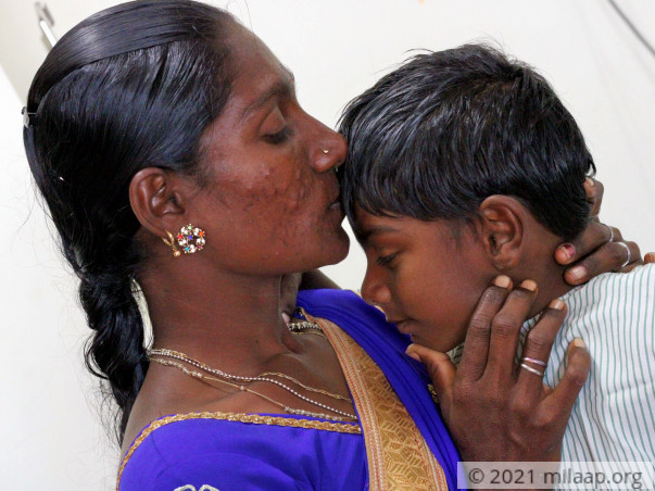 Gowtham Congenital needs your help to fight cardiac problem