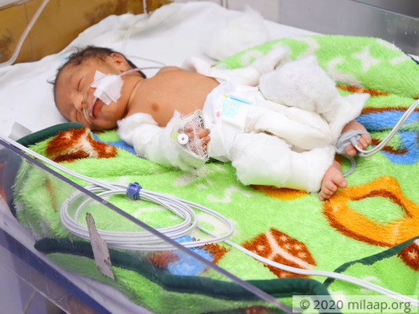 Help Ekta's Preterm Baby Recover