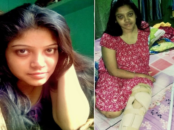 Help Nabanita to Walk Again