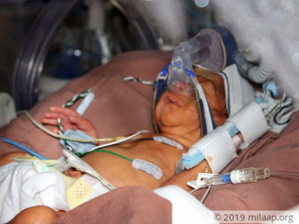 Help My Premature Babies Survive