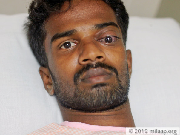 23-YO Suffering From Eye Damage After Cow Attacked Him Needs Help