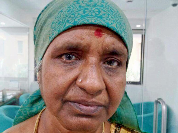 Saraswathi Is A Real Fighter: Help Her Beat Breast Cancer.