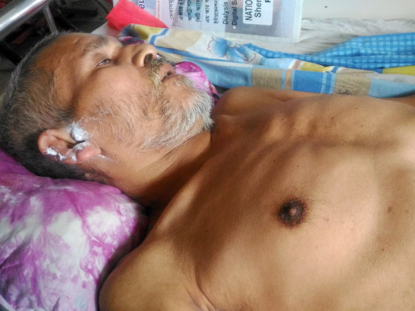 Help My Uncle Faraque To Recover From Pott's Disease.