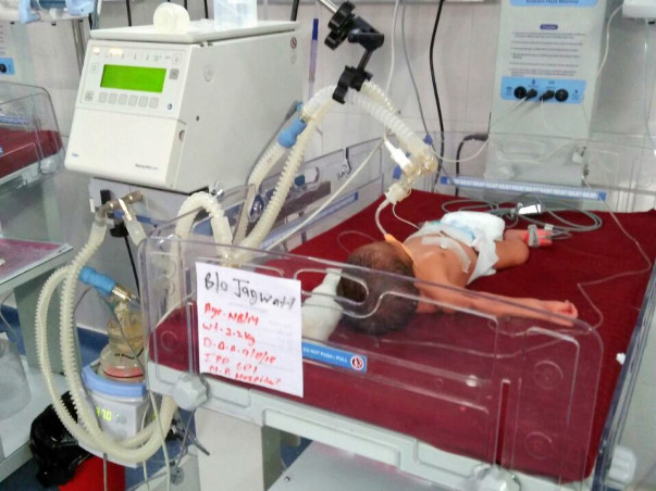 Save Newly Born Baby Suffering From Severe Lung Disease.