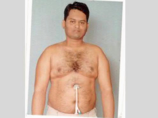 Help Mahaboob fight cancer