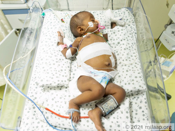 Baby of Naga Lakshmi needs your help to survive