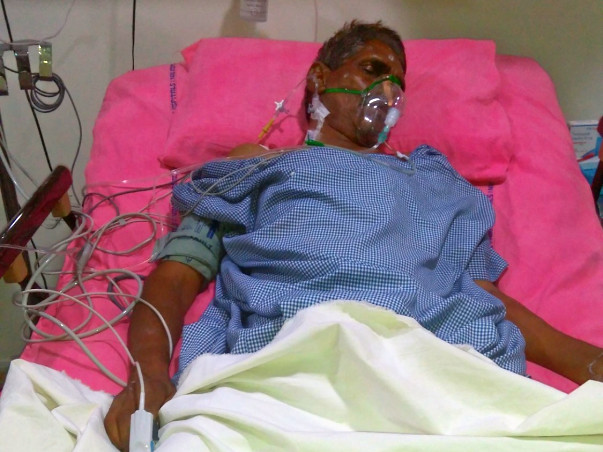 Help My Father From Brain Stroke