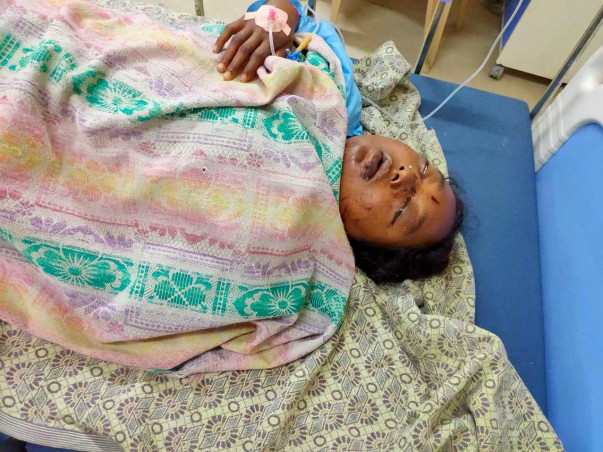 Support Ponnam Sarojana Recover From Accident