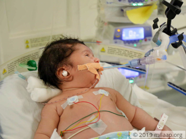 Orphanage Teacher Struggles To Save 10-Day-Old Who Cannot Eat