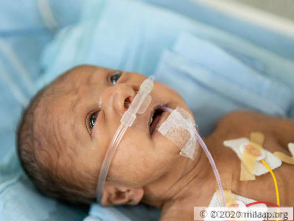 Premature Baby Born With A Hole In The Heart Needs Treatment