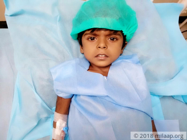 3-year-old Has Abnormal Fluid Collection In Her Stomach