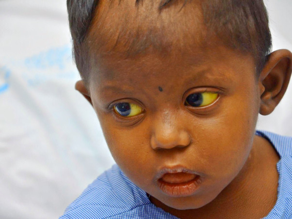 This 4-year-old Who Vomits And Poops Blood Is In Serious Danger