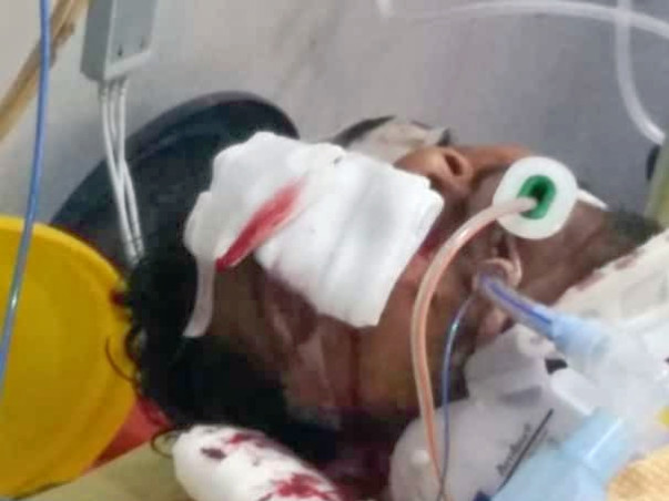 Help My Friend Undergo Brain Surgery And Plastic Surgery To Recover.