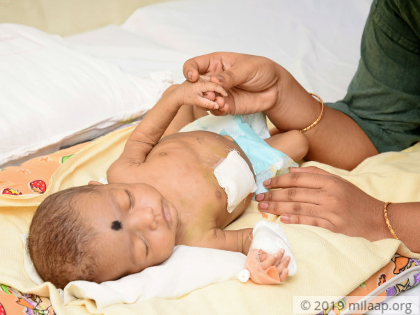 Bhargavi needs your help to undegro her treatment